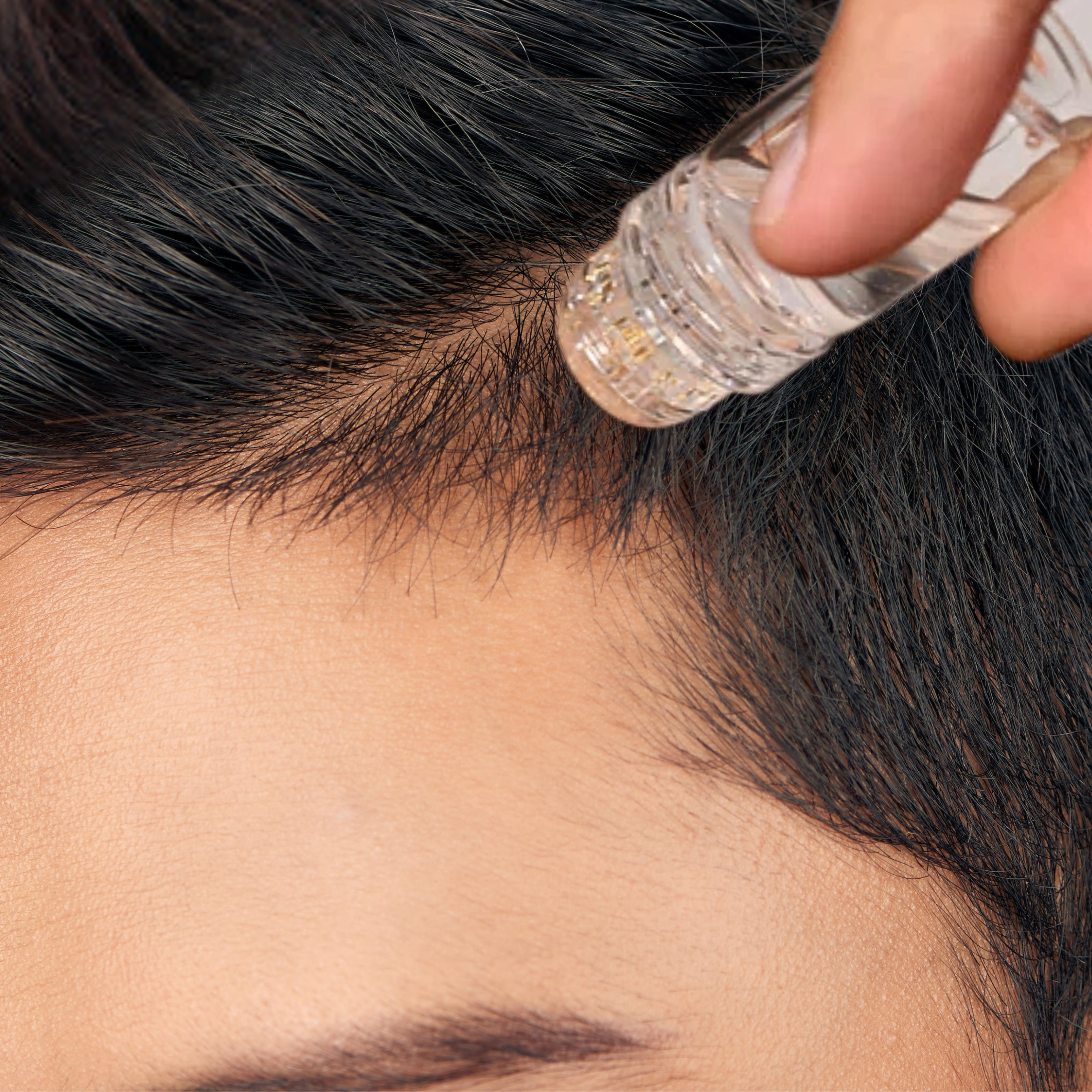 Follicly™ Serumapplikator - Mikroinfusions Titannåle